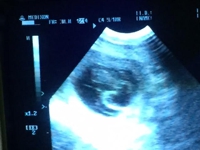 Sonogram 2